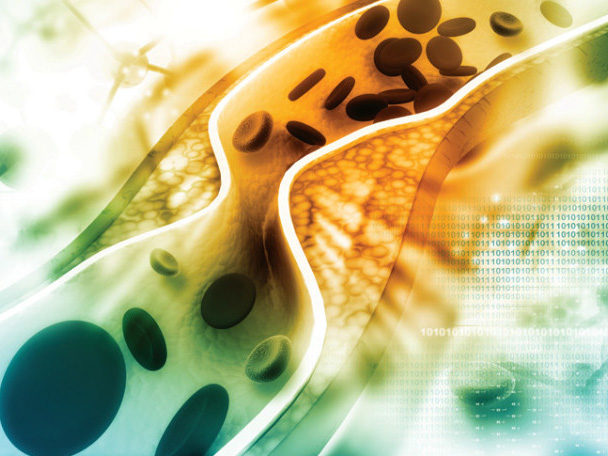 Sự Thật Về Mỡ Trong Máu