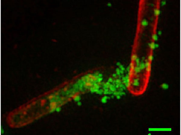 Bước tiến mới trong cuộc chiến chống siêu khuẩn